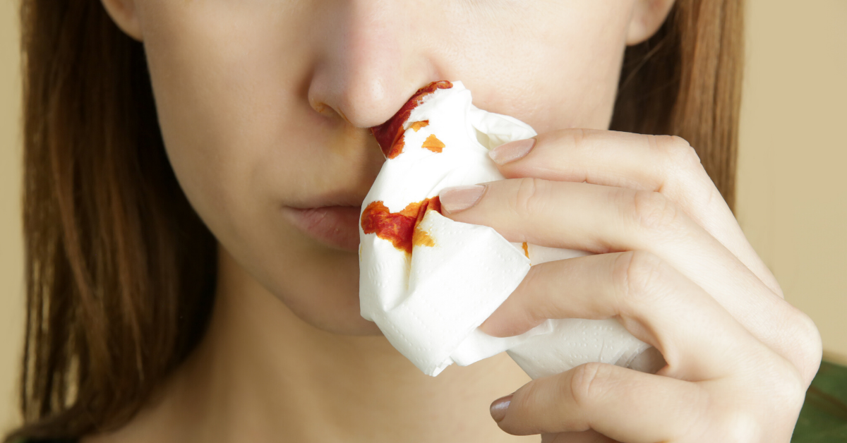 Basic first aid for nosebleed